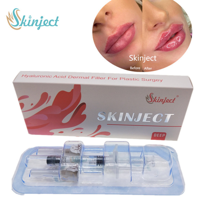 Skinject Füller der tiefe Hyaluronsäure-Haut-Lippen2ml injizierbar