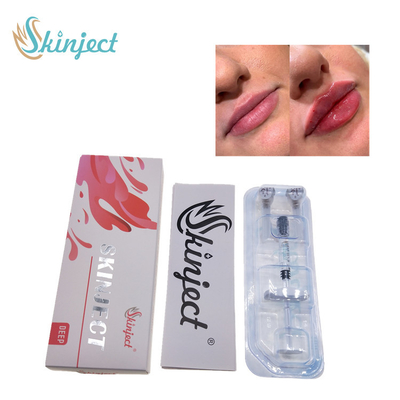 Skinject Füller der tiefe Hyaluronsäure-Haut-Lippen2ml injizierbar
