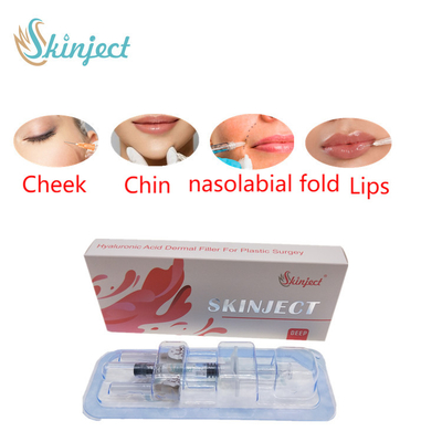Skinject Füller der tiefe Hyaluronsäure-Haut-Lippen2ml injizierbar