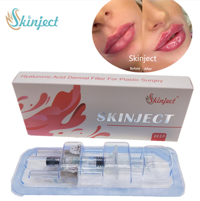 Injizierbare Füller-Backe Chin Nasolabial Fold Skinject tiefe ha Haut-Lippen2ml