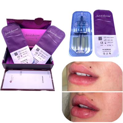 Lippenverbesserung Einspritzungs-ha-Füller Juvederm 2x1ml entfernen Falten