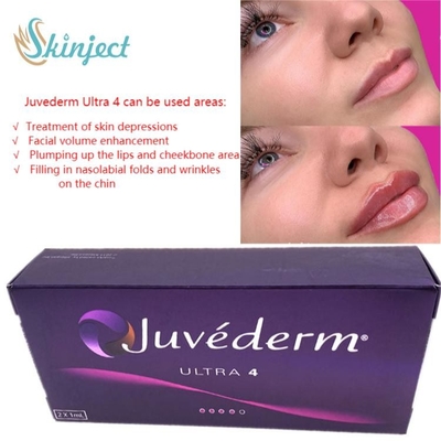 Lippenfüller-Hyaluronsäure-dermalesinjizierbares der Gesichts-Sorgfalt-2x1ml Juvederm