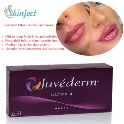 Lippenfüller-Hyaluronsäure-dermalesinjizierbares der Gesichts-Sorgfalt-2x1ml Juvederm