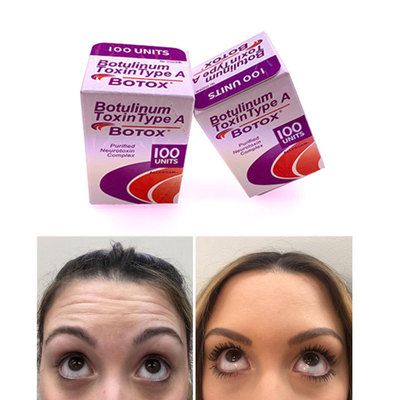 Botulinumgiftstoff-englische Ausgabe 100 IU Allergan