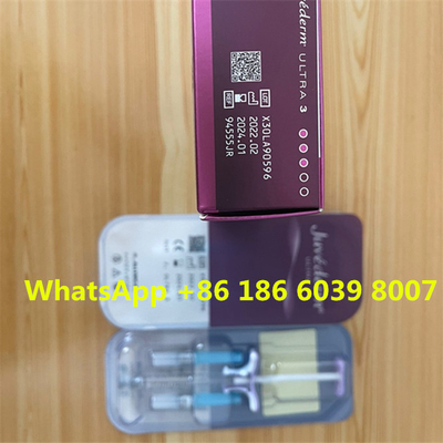 Hautfüller-Lippeneinspritzungen Juvederme ultra 4 für Lippenfüller der Falten-1ml