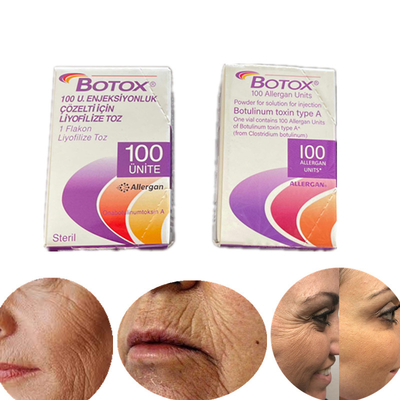 Englische Ausgaben-Art ein Botulinumgiftstoff 100 Iu Allergan  für Falten