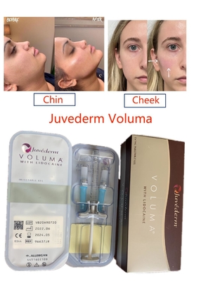 Juvederm Voluma verband Hyaluronsäure-Füller-langlebiges Gesichts-reines injizierbares quer