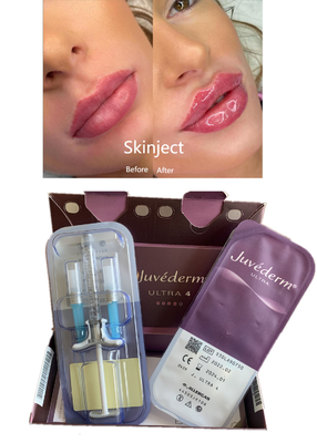 Lippen gestalten Juvederm-Hyaluronsäure-Hautfüller mit Lido Ultra4 2X1ml um