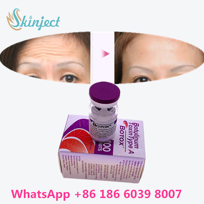 Botulinumgiftstoff  knittern Abbau 100u Allergan 100 Einheiten für Facelift-Einspritzung