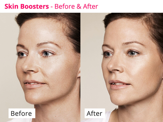 Hyamely-Haut-Regeneration regen Serum-transparente Flüssigkeit des Kollagen-PDRN an