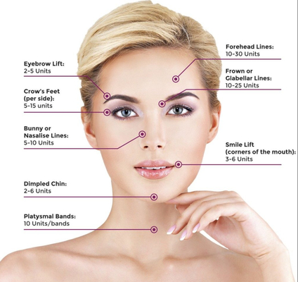 Stirn zeichnet Antihautfüller falte Botulax , die für Facelift Botulinum sind