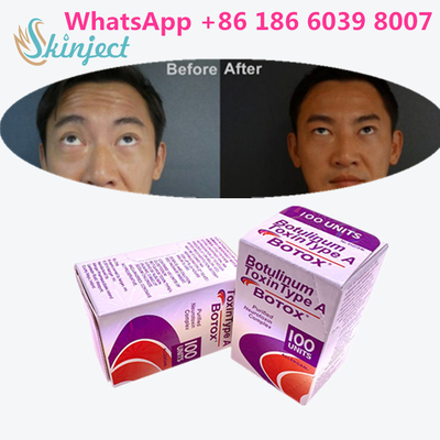 Botulinumgiftstoff Allergan s 1x100iu für Gesichtsfalten