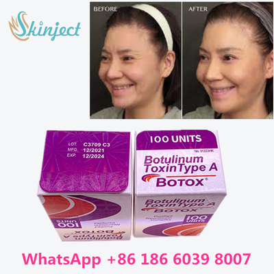 Botulinumphiole/Kasten giftstoff Allergan  100 Iu 200ui 1