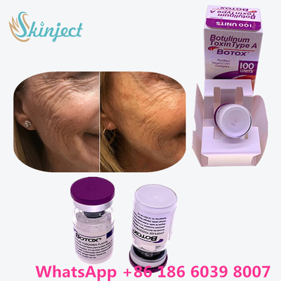 Botulinumgiftstoff Allergan  schreiben eine Verpackung der Phiolen-100units 1/des Kastens