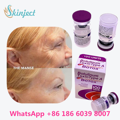 Botulinumgiftstoff Allergan  schreiben eine Verpackung der Phiolen-100units 1/des Kastens