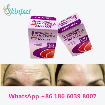 Botulinumgiftstoff Allergan  schreiben eine Verpackung der Phiolen-100units 1/des Kastens