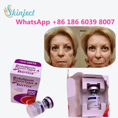 allergan Botulinumgiftstoff alternde Antiprodukte schreiben einem Giftstoff Antifalte