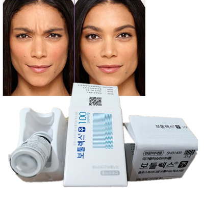 100 Iu Antifalten-Produkt-Korea-Botulinumgiftstoff -Art A