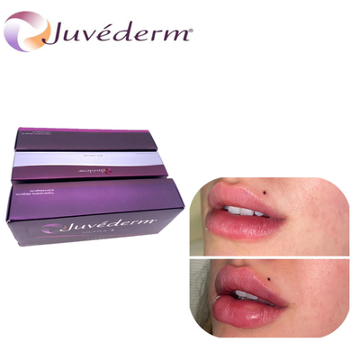 Injizierbarer Hautfüller Ultra3 Ultra4 Voluma für Wangenknochen-Lippe