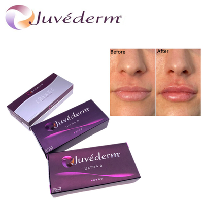 Hyluronsäure Hautfiller Premium Juvederm HA Gesichtsfiller Ultra3 Ultra4 Voluma Für Gesichtsverjüngung