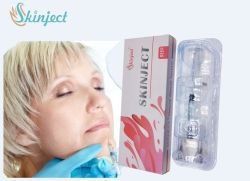 Gesichtslinie / Nase / Lippen / Kieferlinie Hyaluronsäure Hautfüllmittel mit 2 Jahren Haltbarkeit