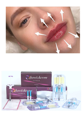 Juvederm' Hyaluronsäure Hautfüllmittel Ultra3 Ultra4 Volumen Injektion zur Lippenfüllung