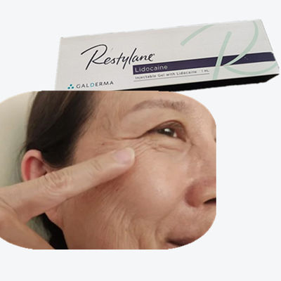 2*1ml/Box Hyaluronsäure-Brustfiller HA Hautfiller für Stirnlinien