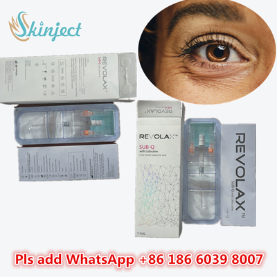 Medizinisches Natriumhyaluronat Gel Hyaluronsäure Dermal Revolax Tieffüllmittel 1 ml zur Lippeninjektion