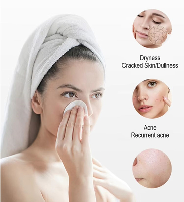 Neue Einführung Schwarze Perle 10 in 1 Hydra Peeling Maschine Mikrodermabrasion Maschine Gesichts Spa Mikrotouch Hydra Hautpflege