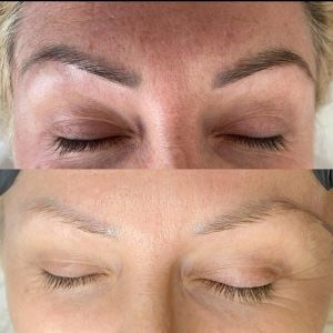 Augenbrauenentfernung Haare entfernen Laser Schönheitsmaschine 810nm Laser Tattoo Entfernung Maschine