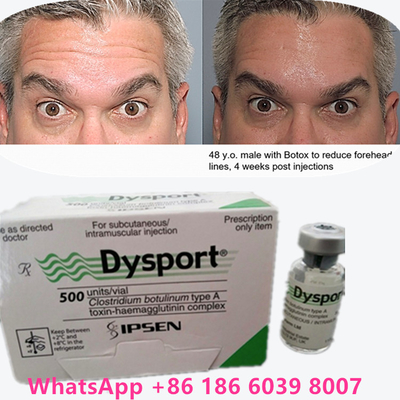 Botulinumtoxin  Pulver Dysport 100 IU/1 Fläschchen für alternde Haut