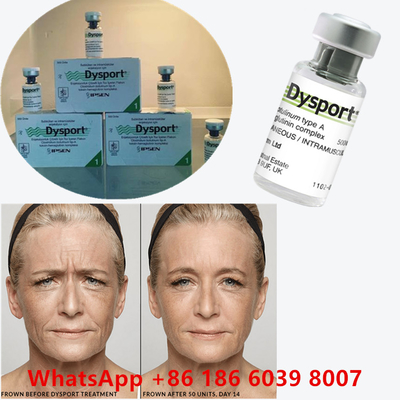 Botulinumtoxin 100 Einheiten BTX Injektion Typ A Kosmetische Anwendung