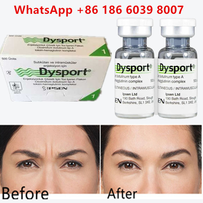 Botulinumtoxin Dysport 100u Clostridium Botulinum Typ A Für Stirnfalten