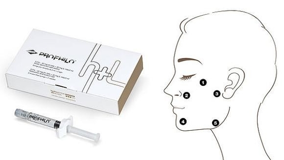 Anti-Aging und Faltenentfernung Profhilo H L 2 ml Hyaluronsäure mit einer Konzentration von 32 mg/ml Ha