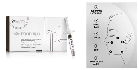 Natürlich aussehendes Lifting 5-Punkt-Lifting-Nadel Profhilo Injektionsfähiger Dermal Filler