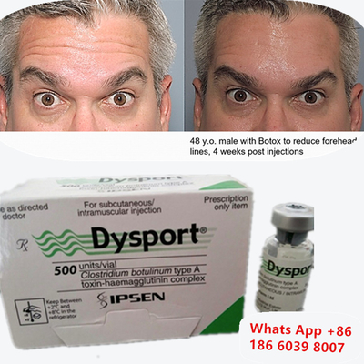 Botulinumtoxin Dysport Botox Clostridium Botulinum Typ A für Augenbrauenlifting