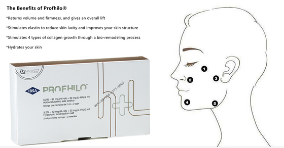 2ml Vernetzter Dermal Filler PROFHILO Anti-Aging-Hautbehandlung Gesicht Weiß Wirksam für Hautverjüngung