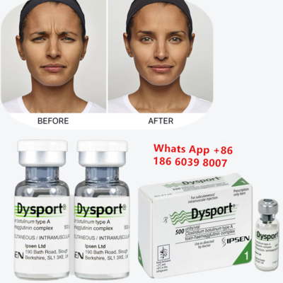 Dysport-Botulinoxin Typ A für Fräulein- und Glabellinien