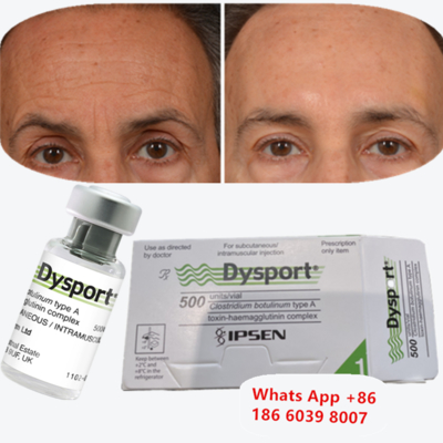 Dysport-Botulinoxin Typ A für Fräulein- und Glabellinien