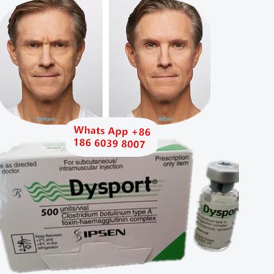 Dysport Botulinum Toxin Typ A-Frisurgetrocknetes Pulver gegen Falten
