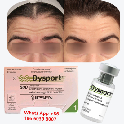 Dysport Botulinum Toxin Typ A Anti-Falten-Injektion für die Perioralen Linien