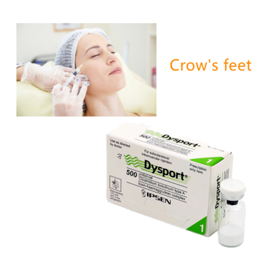 Dysport Typ A 500 Einheiten/ Durchstechflasche Injektionsmittel Entfernen tiefe Falten Botulinumtoxin