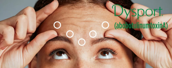 Dysport 500 AbobotulinumtoxinA Botox 500U zur Injektion