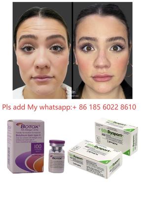 Botulinumtoxin Allergan Botox 100IE zur Faltenreduktion und Kosmetik