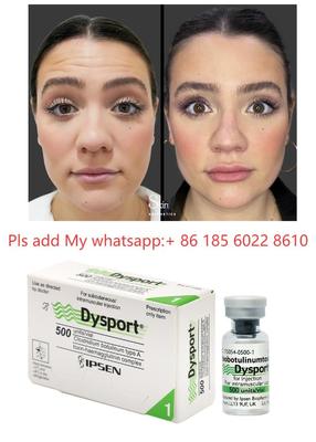 Dysport 500 IE Injektion Anti-Falten Botulinumtoxin Allergan Botulax