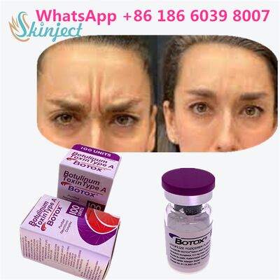 Botulinum Toxin Type A Allergan Botox Offering Designed for Medical and Cosmetic