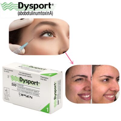 500u Dysport Gesichtsfaltenentfernung Gefriergetrocknetes Pulver Verarbeitung Kundenspezifische OEM Dysport