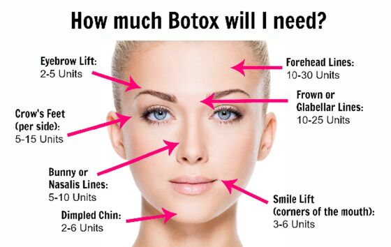 Schönheitssalons Allergen Korea Botulinum Toxin für Anti-Aging und Faltenentfernung