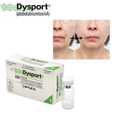 Dysport A-type Botulinum Toxin for Professional Aesthetic Treatments