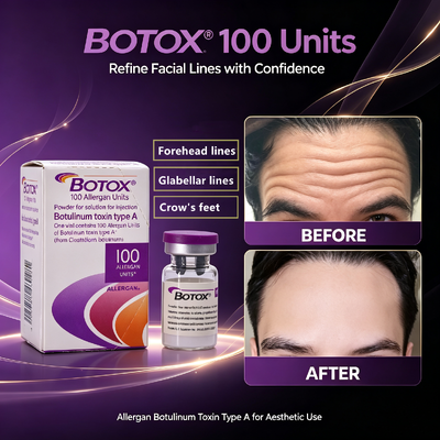 Botox 100 Einheiten Anti-Falten-Injektion Gesichts-Ästhetische Behandlung Allergen Botulinumtoxin Typ A